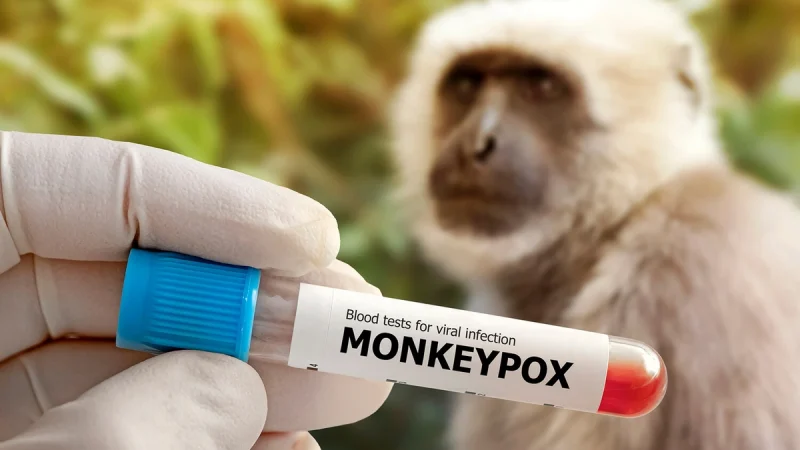 Afrika epidemiya astanasında: Meymunçiçəyi nəzarətdən çıxır